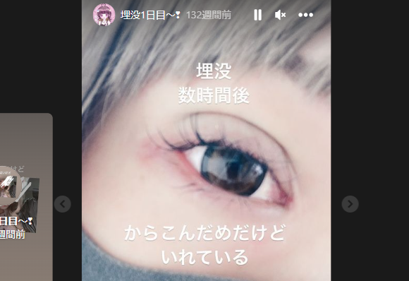 【画像】頂き女子りりちゃんの素顔やすっぴん加工なしは？整形も調査！ | すき間産業ぶろぐ あれこれ知りたい